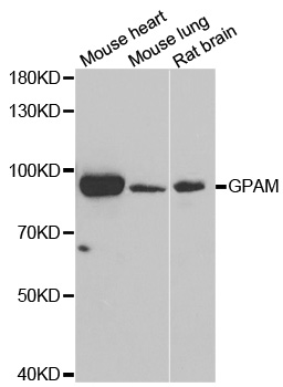 GPAM Antibody - Western blot analysis of extracts of various cell lines.
