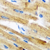 GPAM Antibody - Immunohistochemical analysis of GPAM staining in mouse heart formalin fixed paraffin embedded tissue section. The section was pre-treated using heat mediated antigen retrieval with sodium citrate buffer (pH 6.0). The section was then incubated with the antibody at room temperature and detected using an HRP conjugated compact polymer system. DAB was used as the chromogen. The section was then counterstained with hematoxylin and mounted with DPX.