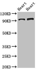 GPAM Antibody - Western Blot Positive WB detected in:Rat heart tissue,Mouse heart tissue All Lanes:GPAM antibody at 3.4µg/ml Secondary Goat polyclonal to rabbit IgG at 1/50000 dilution Predicted band size: 94 KDa Observed band size: 94 KDa