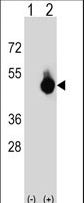 GPANK1 / G5 Antibody - Western blot of BAT4 (arrow) using rabbit polyclonal BAT4 Antibody. 293 cell lysates (2 ug/lane) either nontransfected (Lane 1) or transiently transfected (Lane 2) with the BAT4 gene.