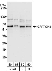 GPATCH4 Antibody - Detection of Human GPATCH4 by Western Blot. Samples: Whole cell lysate from 293T (15 and 50 ug), Jurkat (J; 50 ug) and HeLa (H; 50 ug) cells. Antibody: Affinity purified rabbit anti-GPATCH4 antibody used for WB at 0.04 ug/ml. Detection: Chemiluminescence with an exposure time of 10 seconds.