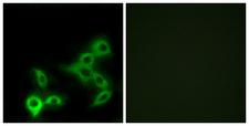 GPBAR1 / TGR5 Antibody - Immunofluorescence analysis of LOVO cells, using GPBAR Antibody. The picture on the right is blocked with the synthesized peptide.