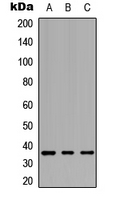 GPBAR1 / TGR5 Antibody - Western blot analysis of GPCR19 expression in HEK293T (A); Raw264.7 (B); PC12 (C) whole cell lysates.