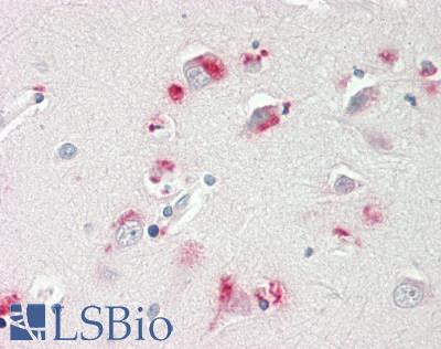 GPBB / PYGB Antibody - Human Brain, Cortex: Formalin-Fixed, Paraffin-Embedded (FFPE).  This image was taken for the unconjugated form of this product. Other forms have not been tested.