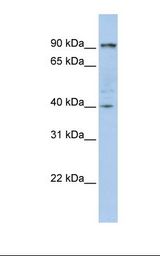 GPBB / PYGB Antibody - 721_B cell lysate. Antibody concentration: 1.0 ug/ml. Gel concentration: 12%.  This image was taken for the unconjugated form of this product. Other forms have not been tested.