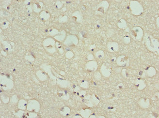 GPBB / PYGB Antibody - Immunohistochemistry of paraffin-embedded human brain tissue using PYGB Antibody at dilution of 1:100