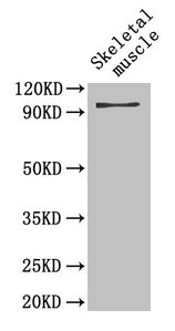 GPBB / PYGB Antibody - Western Blot Positive WB detected in: Mouse skeletal muscle All lanes: PYGB antibody at 4µg/ml Secondary Goat polyclonal to rabbit IgG at 1/50000 dilution Predicted band size: 96 kDa Observed band size: 96 kDa