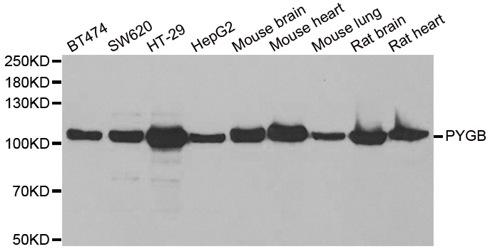 GPBB / PYGB Antibody - Western blot analysis of extracts of various cell lines.