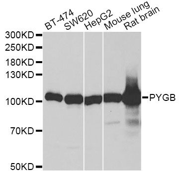 GPBB / PYGB Antibody - Western blot analysis of extracts of various cell lines, using PYGB antibody at 1:1000 dilution. The secondary antibody used was an HRP Goat Anti-Rabbit IgG (H+L) at 1:10000 dilution. Lysates were loaded 25ug per lane and 3% nonfat dry milk in TBST was used for blocking. An ECL Kit was used for detection and the exposure time was 30s.