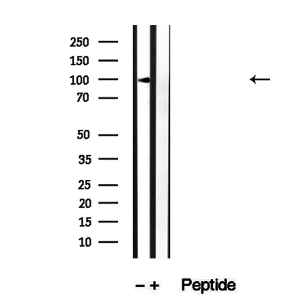 GPBB / PYGB Antibody - Western blot analysis of extracts of rat brain tissue using PYGB antibody.