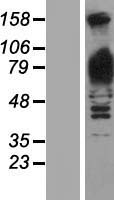GPBB / PYGB Protein - Western validation with an anti-DDK antibody * L: Control HEK293 lysate R: Over-expression lysate