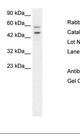 GPBP1 Antibody - Western blot of Hep2G cell lysate.  This image was taken for the unconjugated form of this product. Other forms have not been tested.