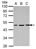 GPBP1 Antibody - Sample (30 ug of whole cell lysate) A: Jurkat B: K562 C: HL-60 10% SDS PAGE GPBP1 antibody diluted at 1:2000