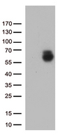 GPC1 / Glypican Antibody - HEK293T cells were transfected with the pCMV6-ENTRY control. (Left lane) or pCMV6-ENTRY GPC1. (Right lane) cDNA for 48 hrs and lysed. Equivalent amounts of cell lysates. (5 ug per lane) were separated by SDS-PAGE and immunoblotted with anti-GPC1. (1:500)