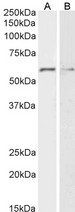 GPC1 / Glypican Antibody - Goat Anti-Glypican-1 Antibody (2µg/ml) staining of HeLa (A) and K562 (B) lysates (35µg protein in RIPA buffer). Primary incubation was 1 hour. Detected by chemiluminescencence.