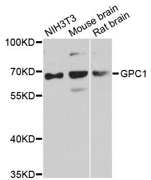 GPC1 / Glypican Antibody - Western blot analysis of extracts of various cell lines, using GPC1 antibody at 1:3000 dilution. The secondary antibody used was an HRP Goat Anti-Rabbit IgG (H+L) at 1:10000 dilution. Lysates were loaded 25ug per lane and 3% nonfat dry milk in TBST was used for blocking. An ECL Kit was used for detection and the exposure time was 60s.