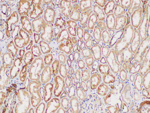 GPC1 / Glypican Antibody - Immunohistochemistry of paraffin-embedded Human kidney using GPC1 Polycloanl Antibody at dilution of 1:300