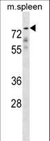 GPC2 / Glypican 2 Antibody - GPC2 Antibody western blot of mouse spleen tissue lysates (35 ug/lane). The GPC2 antibody detected the GPC2 protein (arrow).