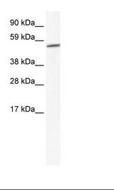 GPC3 / Glypican 3 Antibody - Placenta Lysate.  This image was taken for the unconjugated form of this product. Other forms have not been tested.
