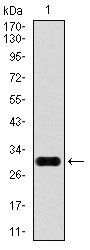 GPC3 / Glypican 3 Antibody - Western blot using GPC3 monoclonal antibody against human GPC3 (AA: 55-200) recombinant protein. (Expected MW is 28.5 kDa)