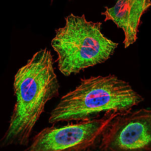 GPC3 / Glypican 3 Antibody - Immunofluorescence of HeLa cells using GPC3 mouse monoclonal antibody (green). Blue: DRAQ5 fluorescent DNA dye. Red: Actin filaments have been labeled with Alexa Fluor-555 phalloidin.