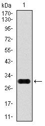 GPC3 / Glypican 3 Antibody - Glypican 3 Antibody in Western Blot (WB)