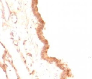 GPC3 / Glypican 3 Antibody - Formalin-fixed, paraffin-embedded rat lung stained with Glypican-3 antibody (GPC3/863).  This image was taken for the unmodified form of this product. Other forms have not been tested.
