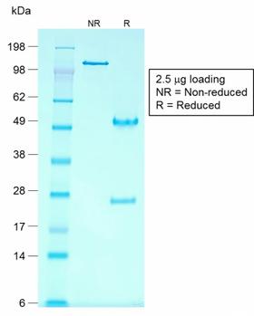 GPC3 / Glypican 3 Antibody - SDS-PAGE Analysis Purified Glypican-3 Mouse Recombinant Monoclonal Ab (rGPC3/863). Confirmation of Purity and Integrity of Antibody.