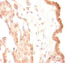 GPC3 / Glypican 3 Antibody - IHC testing of FFPE rat lung with Glypican-3 antibody (SGPN3-1).  This image was taken for the unmodified form of this product. Other forms have not been tested.