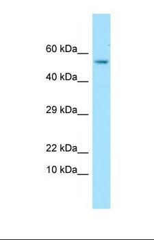 GPC4 / Glypican 4 Antibody - Western blot of Human HT1080. GPC4 antibody dilution 1.0 ug/ml.  This image was taken for the unconjugated form of this product. Other forms have not been tested.