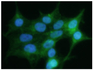 GPC4 / Glypican 4 Antibody - ICC/IF analysis of GPC4 in 293T cells line, stained with DAPI (Blue) for nucleus staining and monoclonal anti-human GPC4 antibody (1:200) with goat anti-mouse IgG-Alexa fluor 488 conjugate (Green).