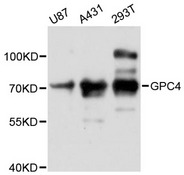GPC4 / Glypican 4 Antibody - Western blot analysis of extracts of various cell lines, using GPC4 antibody at 1:3000 dilution. The secondary antibody used was an HRP Goat Anti-Rabbit IgG (H+L) at 1:10000 dilution. Lysates were loaded 25ug per lane and 3% nonfat dry milk in TBST was used for blocking. An ECL Kit was used for detection and the exposure time was 30s.