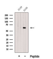 GPC4 / Glypican 4 Antibody - Western blot analysis of extracts of A549 cells using Glypican4 antibody. The lane on the left was treated with blocking peptide.
