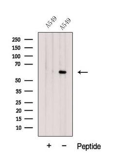 GPC4 / Glypican 4 Antibody - Western blot analysis of extracts of A549 cells using Glypican4 antibody. The lane on the left was treated with blocking peptide.
