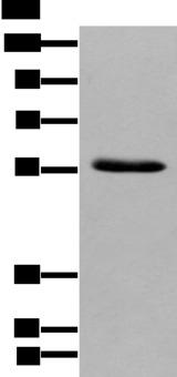 GPC4 / Glypican 4 Antibody - Western blot analysis of Human pancreas tissue  using GPC4 Polyclonal Antibody at dilution of 1:500