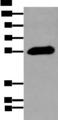 GPC4 / Glypican 4 Antibody - Western blot analysis of Human pancreas tissue  using GPC4 Polyclonal Antibody at dilution of 1:200
