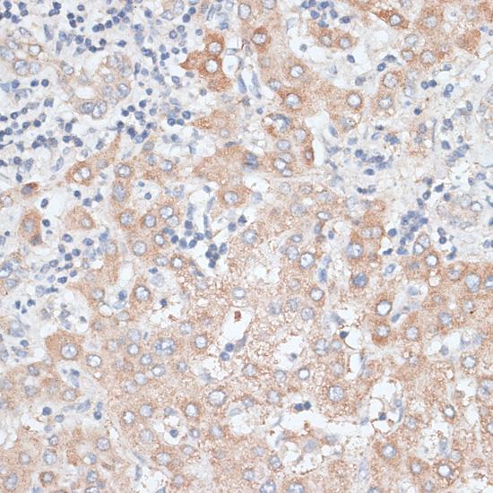GPC4 / Glypican 4 Antibody - Immunohistochemistry of paraffin-embedded Human liver using GPC4 Polyclonal Antibody at dilution of 1:100 (40x lens).
