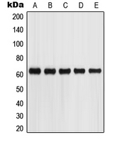 GPC5 / Glypican 5 Antibody - Western blot analysis of Glypican 5 expression in SKNSH (A); HepG2 (B); A549 (C); Jurkat (D); HEK293T (E) whole cell lysates.