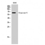 GPC5 / Glypican 5 Antibody - Western blot of Glypican-5 antibody
