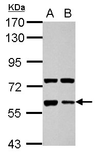 GPC5 / Glypican 5 Antibody - Sample (30 ug of whole cell lysate) A: NT2D1 B: SK-N-SH 7.5% SDS PAGE GPC5 / Glypican 5 antibody diluted at 1:1000