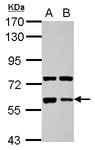 GPC5 / Glypican 5 Antibody - Sample (30 ug of whole cell lysate) A: NT2D1 B: SK-N-SH 7.5% SDS PAGE GPC5 / Glypican 5 antibody diluted at 1:1000