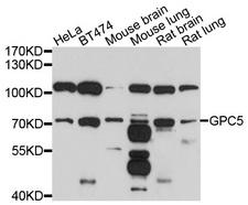 GPC5 / Glypican 5 Antibody - Western blot analysis of extracts of various cell lines, using GPC5 antibody at 1:1000 dilution. The secondary antibody used was an HRP Goat Anti-Rabbit IgG (H+L) at 1:10000 dilution. Lysates were loaded 25ug per lane and 3% nonfat dry milk in TBST was used for blocking. An ECL Kit was used for detection and the exposure time was 90s.