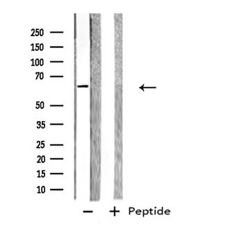 GPC5 / Glypican 5 Antibody - Western blot analysis of extracts of 293 cells using GPC5 antibody.