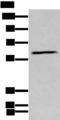GPC5 / Glypican 5 Antibody - Western blot analysis of Human fetal brain tissue lysate  using GPC5 Polyclonal Antibody at dilution of 1:450