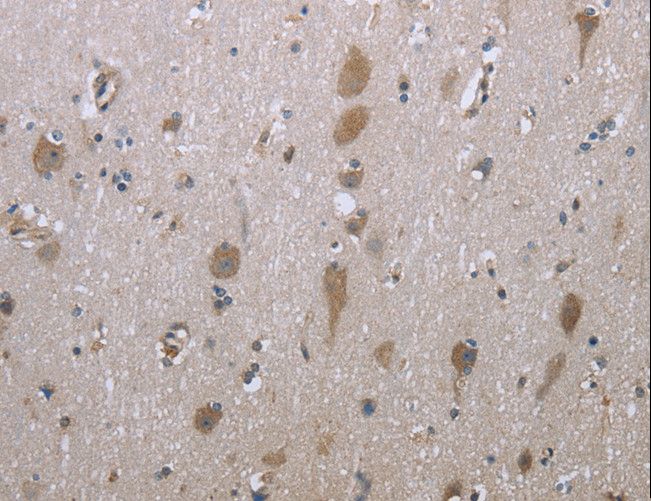 GPC6 / Glypican 6 Antibody - Immunohistochemistry of paraffin-embedded Human brain using GPC6 Polyclonal Antibody at dilution of 1:40.