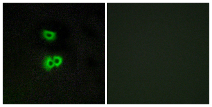 GPCR6 / GPR101 Antibody - Immunofluorescence analysis of A549 cells, using GPR101 Antibody. The picture on the right is blocked with the synthesized peptide.