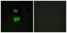 GPCR6 / GPR101 Antibody - Immunofluorescence analysis of A549 cells, using GPR101 Antibody. The picture on the right is blocked with the synthesized peptide.