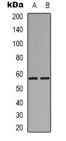 GPCR6 / GPR101 Antibody - Western blot analysis of GPR101 expression in HeLa (A); rat muscle (B) whole cell lysates.
