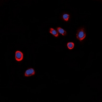 GPCR6 / GPR101 Antibody - Immunofluorescent analysis of GPR101 staining in HeLa cells. Formalin-fixed cells were permeabilized with 0.1% Triton X-100 in TBS for 5-10 minutes and blocked with 3% BSA-PBS for 30 minutes at room temperature. Cells were probed with the primary antibody in 3% BSA-PBS and incubated overnight at 4 deg C in a humidified chamber. Cells were washed with PBST and incubated with a DyLight 594-conjugated secondary antibody (red) in PBS at room temperature in the dark. DAPI was used to stain the cell nuclei (blue).
