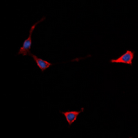 GPCR6 / GPR101 Antibody - Immunofluorescent analysis of GPR101 staining in Jurkat cells. Formalin-fixed cells were permeabilized with 0.1% Triton X-100 in TBS for 5-10 minutes and blocked with 3% BSA-PBS for 30 minutes at room temperature. Cells were probed with the primary antibody in 3% BSA-PBS and incubated overnight at 4 ??C in a humidified chamber. Cells were washed with PBST and incubated with a DyLight 594-conjugated secondary antibody (red) in PBS at room temperature in the dark. DAPI was used to stain the cell nuclei (blue).